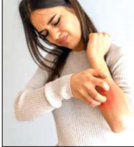 शरीरावर येणाऱ्या खाजेपासून सुटका मिळण्यासाठी...